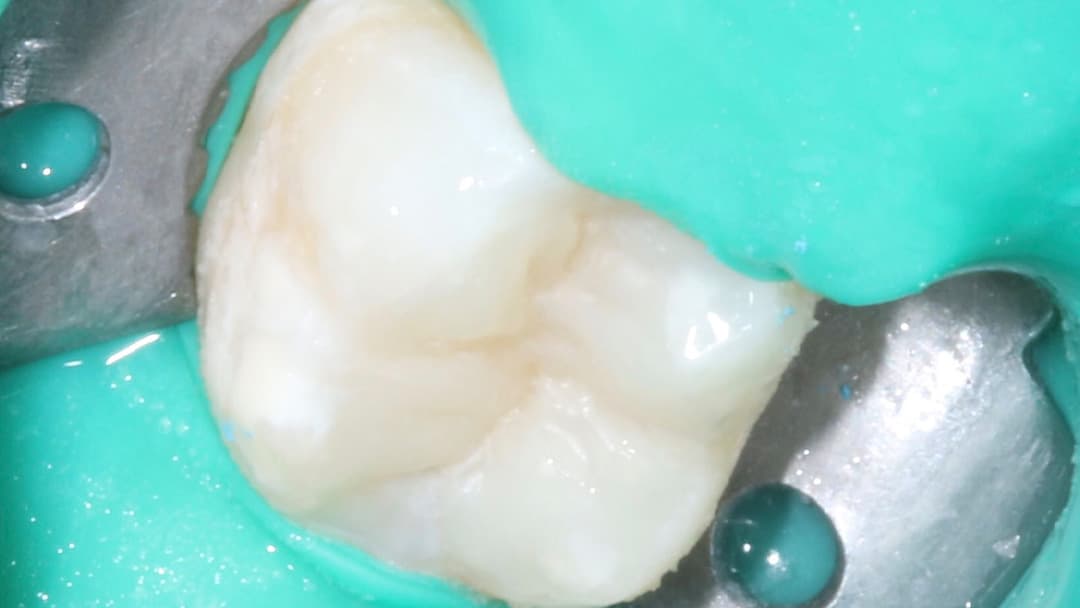 Результат лечения