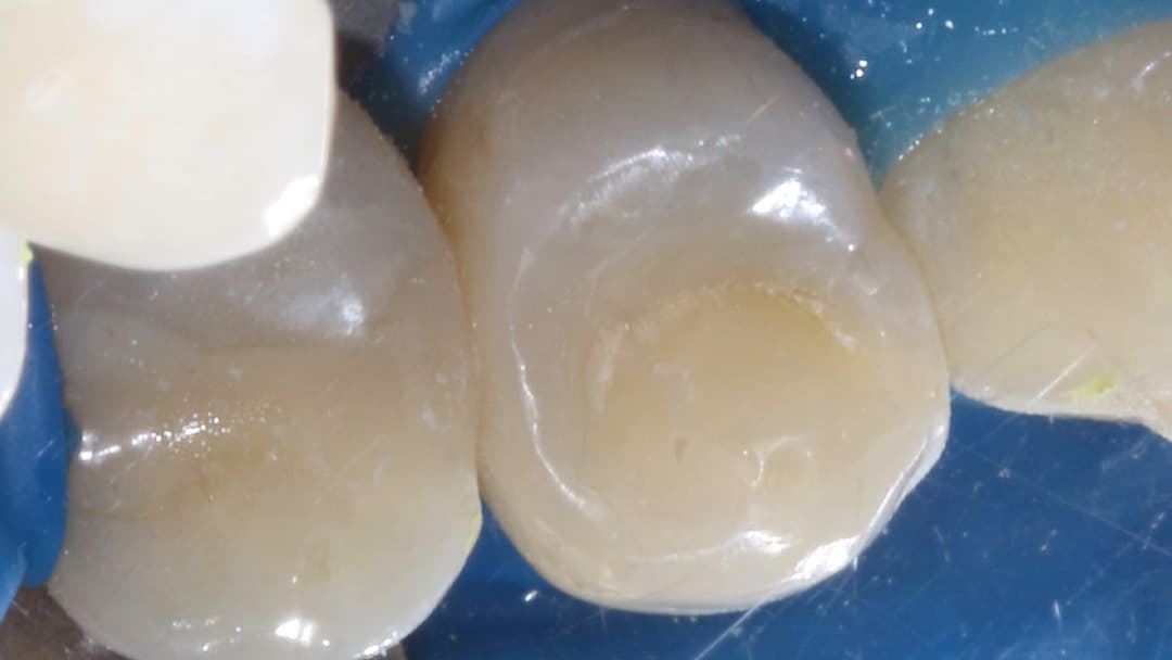 Результат лечения