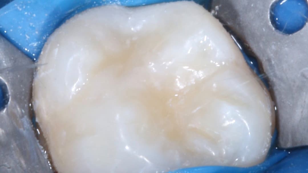 Результат лечения