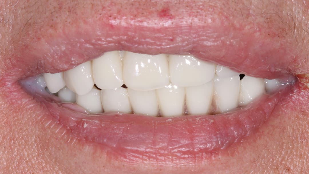 Результат лечения