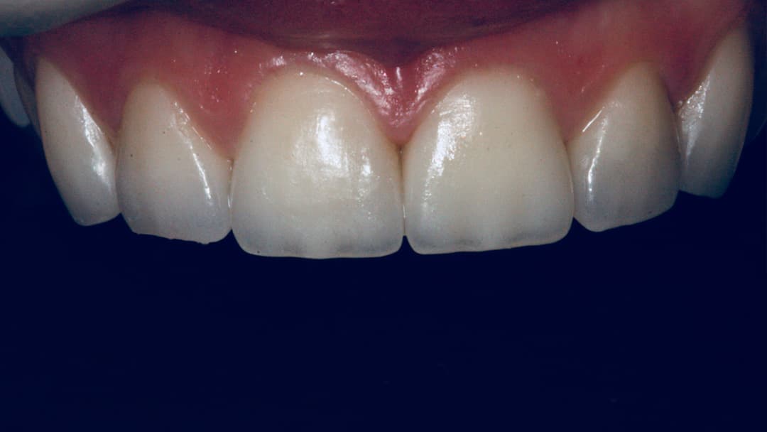 Результат лечения